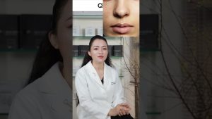 Nguyên bào sợi hay EGF tốt hơn?