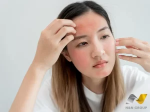 Viêm da – Vấn đề da liễu phổ biến nhưng dễ bị xem nhẹ