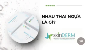 BÍ MẬT DƯỠNG DA CỦA HOÀNG GIA: NHAU THAI NGỰA